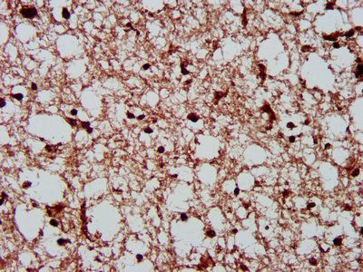 CSNK2A1 Antibody
