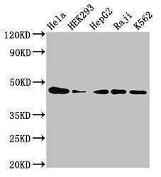 CSNK2A1 antibody