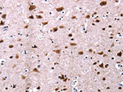 CSNK2A1 Antibody