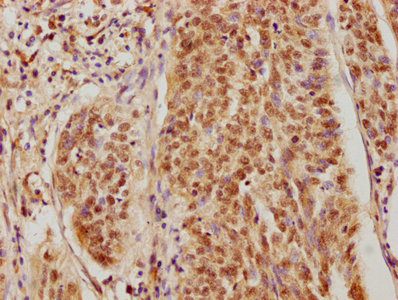 CSNK2A3 Antibody