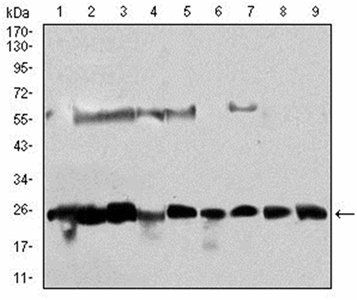 CSNK2B Antibody