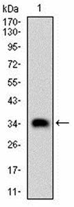 CSNK2B Antibody