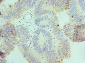 CSRNP1 Antibody