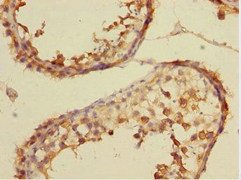 CSRNP2 Antibody