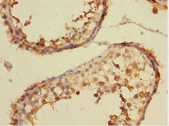 CSRNP2 antibody