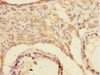 CSRNP2 Antibody