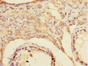 CSRNP2 antibody