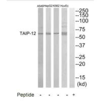 CSRNP2 Antibody