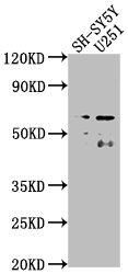 CSRNP3 Antibody