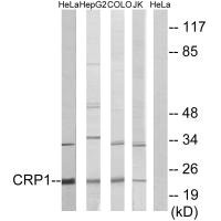 CSRP1 antibody