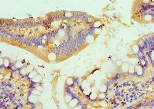 CSRP2BP antibody