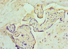 CSRP2BP antibody