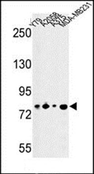 CSRP2BP antibody