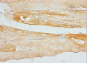 CSRP3 Antibody
