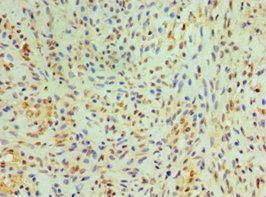 CST4 Antibody
