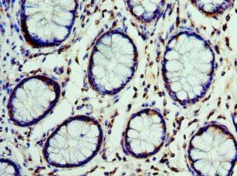 CST7 Antibody