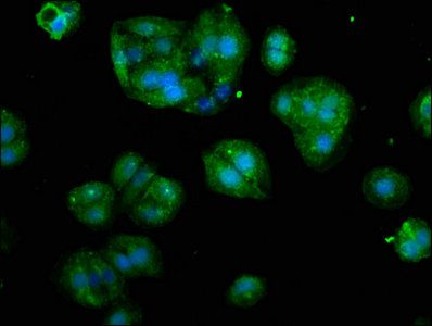 CSTA antibody