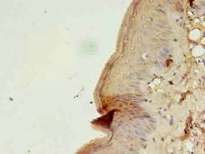 CSTA Antibody