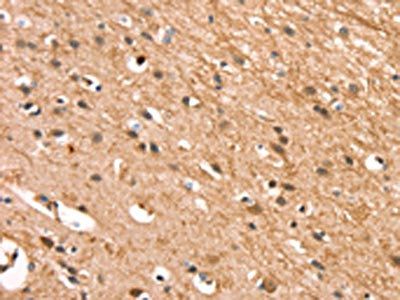CSTB Antibody