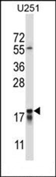 CTAG2 antibody