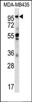 CTAGE5 antibody