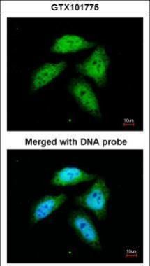 CtBP1 Rabbit Polyclonal Antibody