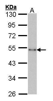CtBP1 Rabbit Polyclonal Antibody