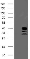 CTDSP1 Antibody