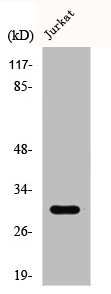 CTDSP1 Antibody