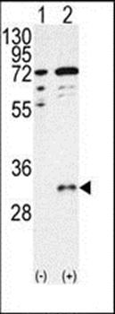 CTDSP1-V250 antibody