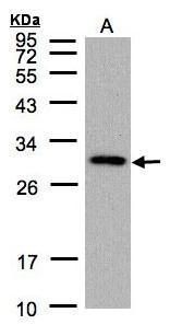 CTD small phosphatase 2 Antibody