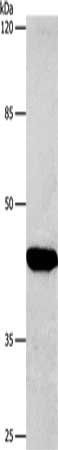 CTGF antibody