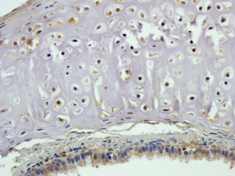 CTGF antibody