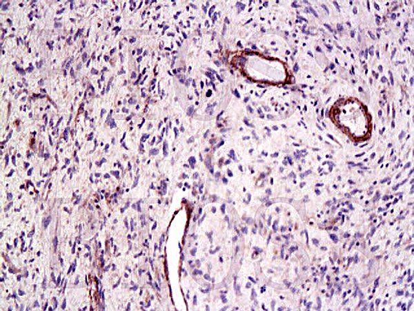 CTGF Rabbit Polyclonal Antibody