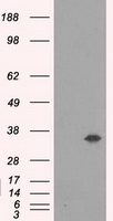 CTLA4 Antibody