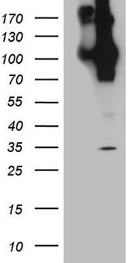 CTLA4 Antibody