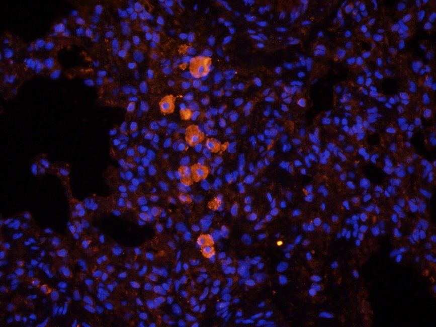 CTLA4 antibody