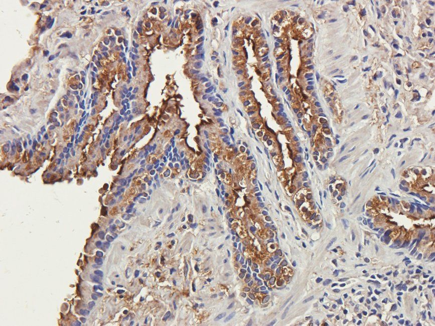 CTLA4 antibody