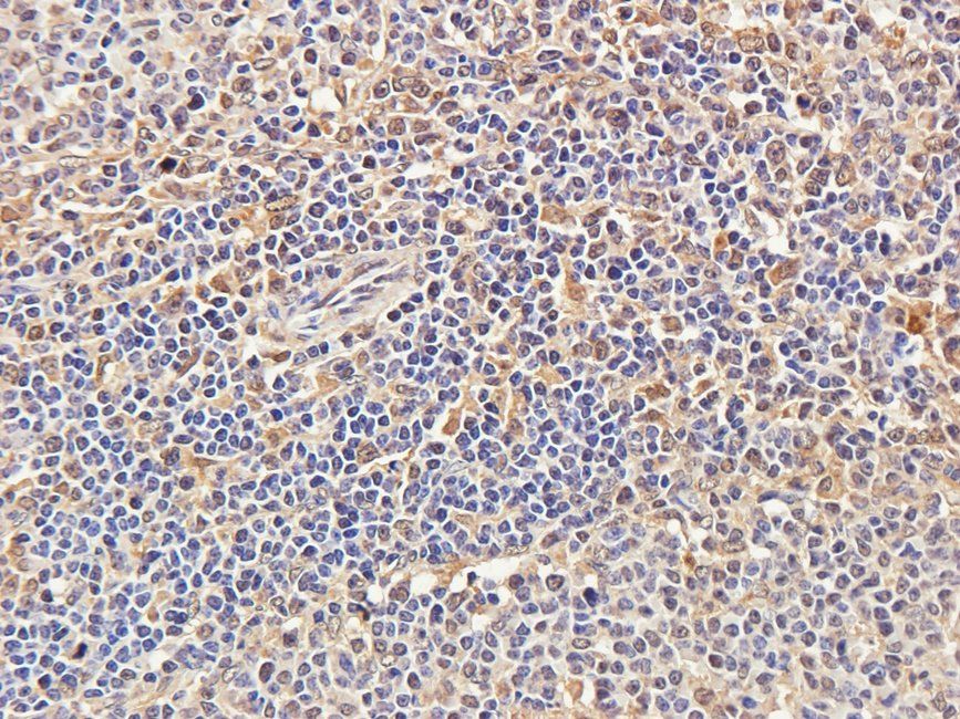 CTLA4 antibody