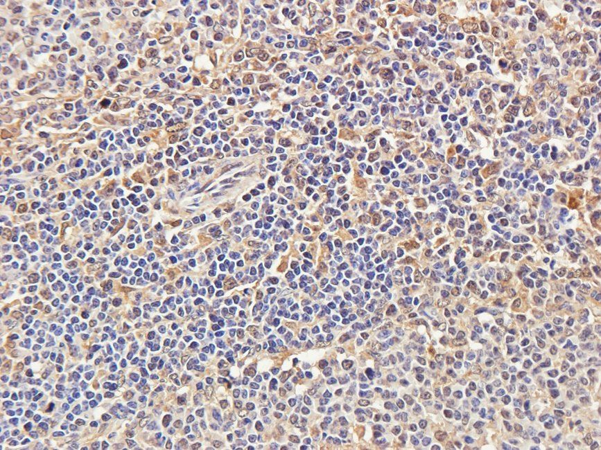 CTLA4 antibody