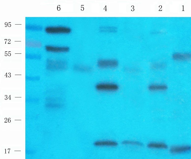 CTLA4 antibody