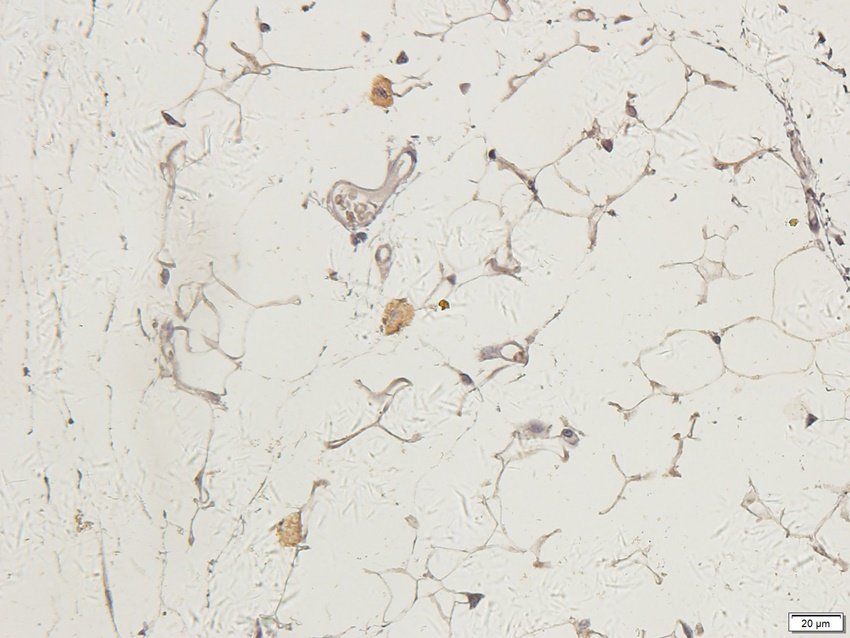 CTLA4 antibody