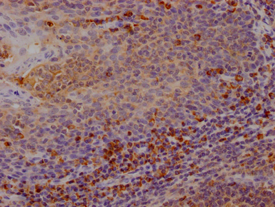 CTLA4 antibody