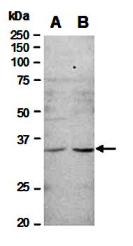 CTLA4 (C) Antibody, Rabbit Polyclonal