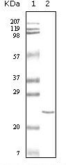 cTnI Antibody