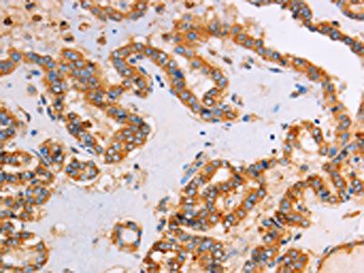 CTNNA1 Antibody