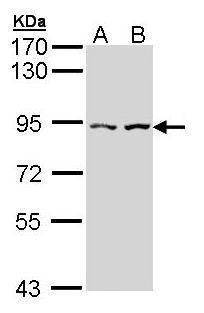 CTNNAL1 antibody