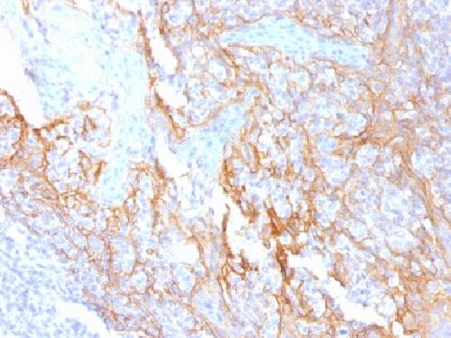 CTNNB1 Antibody