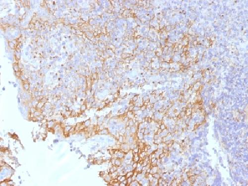 CTNNB1 Antibody