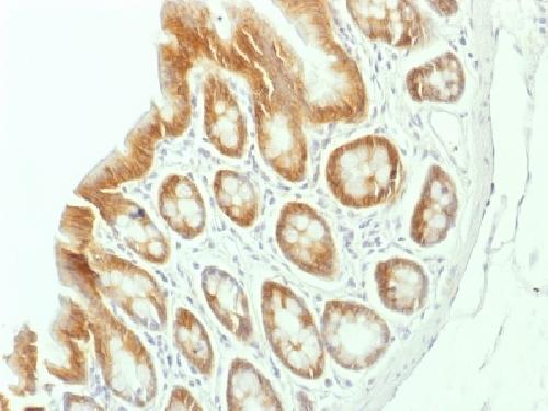 Catenin, beta (p120) Antibody